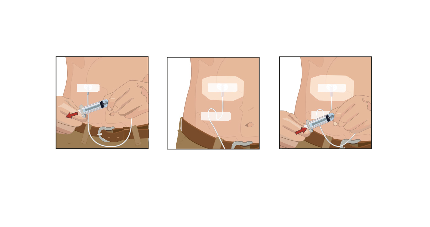 H12125 1024. illustration–fred van deelen medical