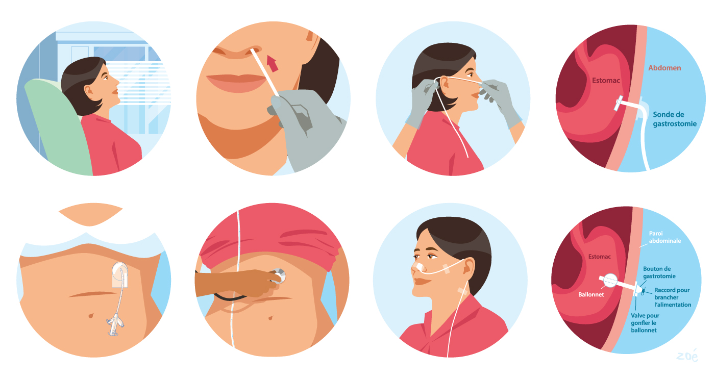 illustration Zoe Fresenius 02 03