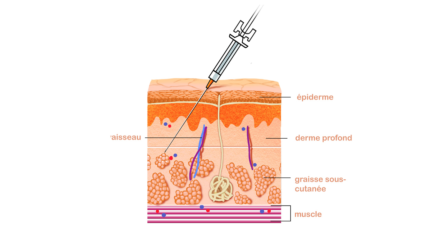 illustration fred van deelen medical