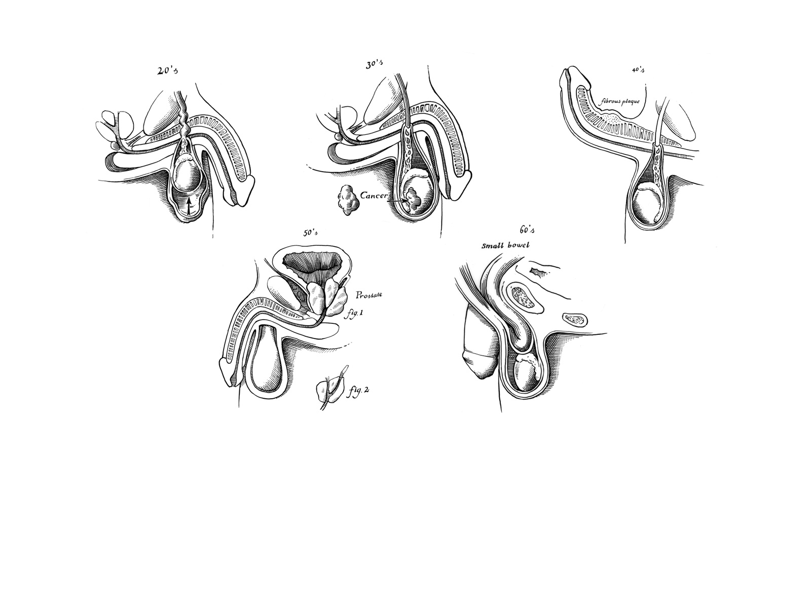 VANDEELENFred-Illustrations-MEDICALE-2764