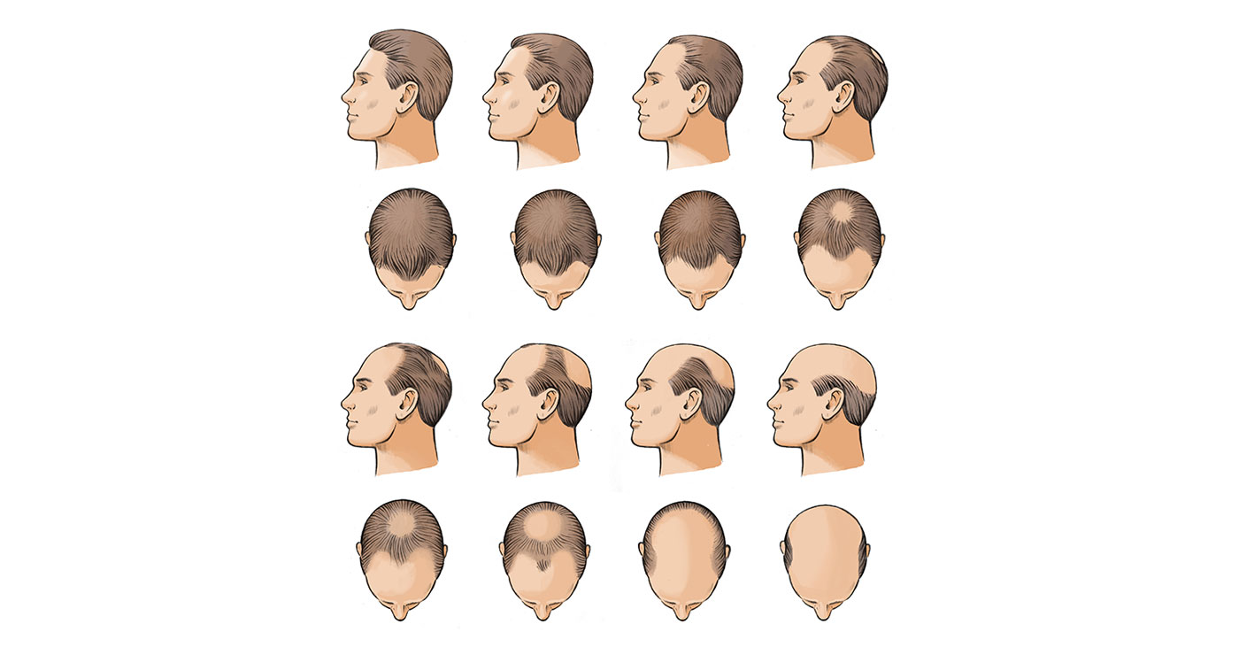 fred-van-deelen-vignettes-medicale-cheveux-651