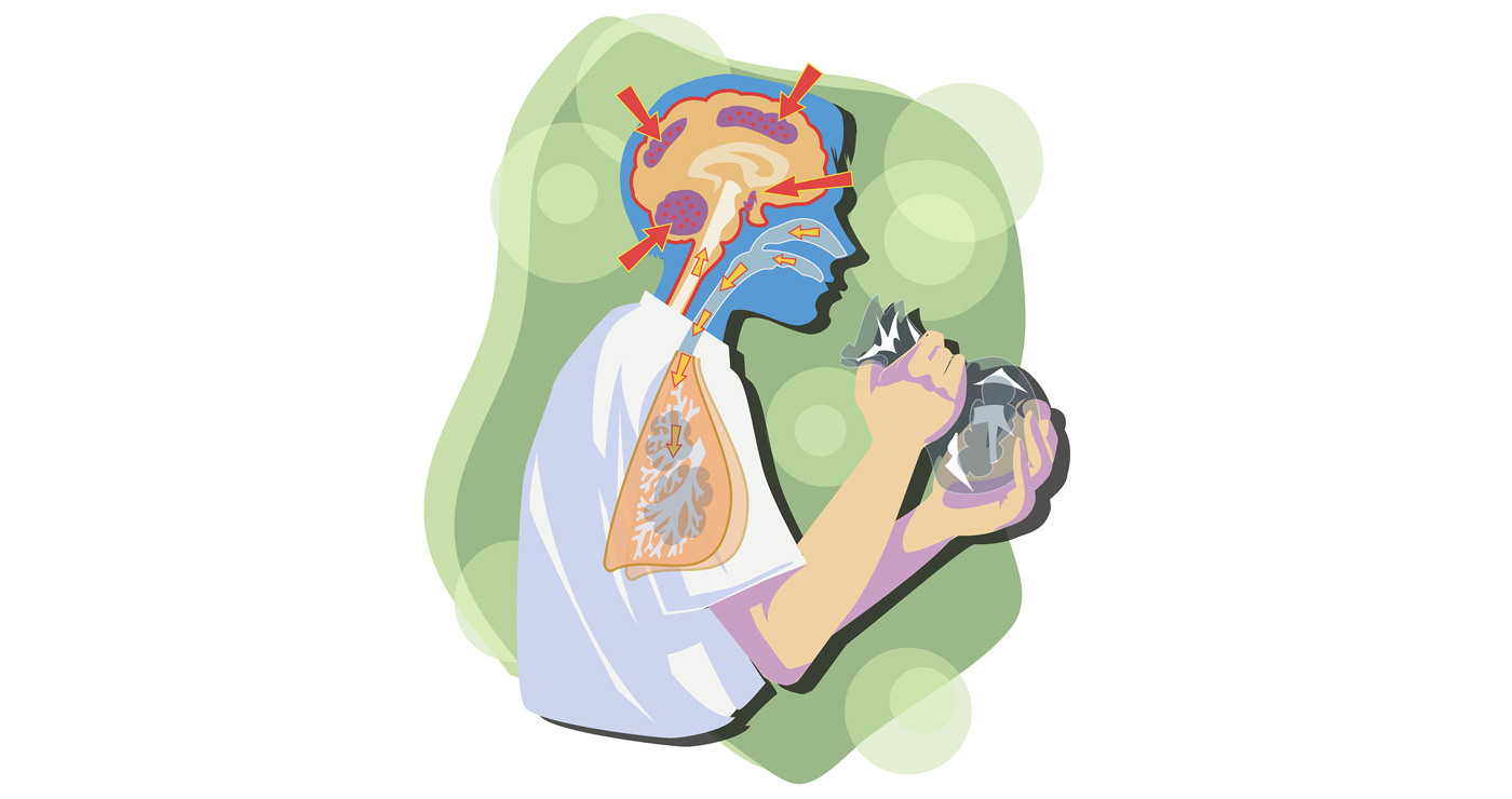 illustration fred van deelen medical 2