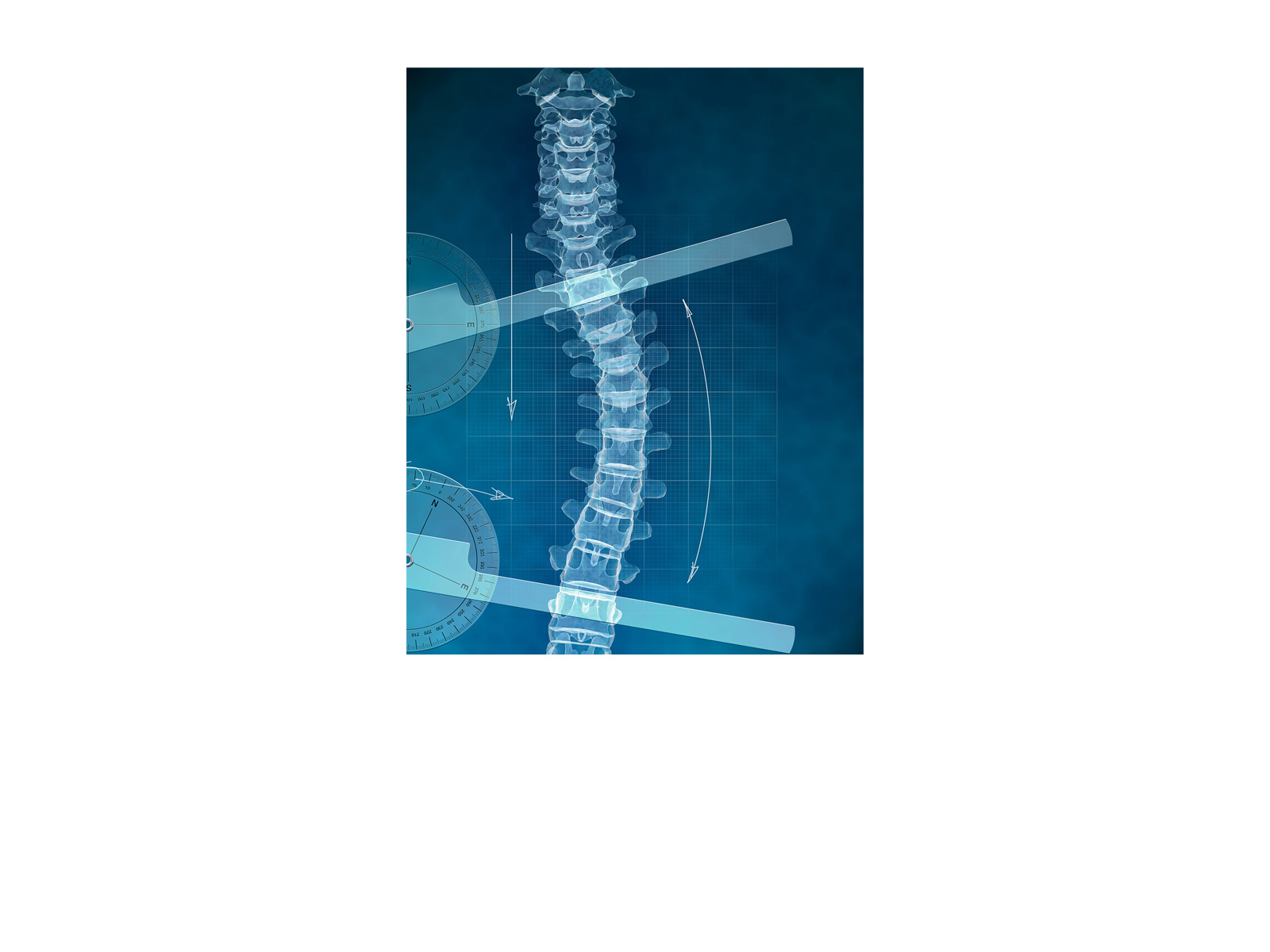 jean-pascal-donnot-3D-Orthopedic