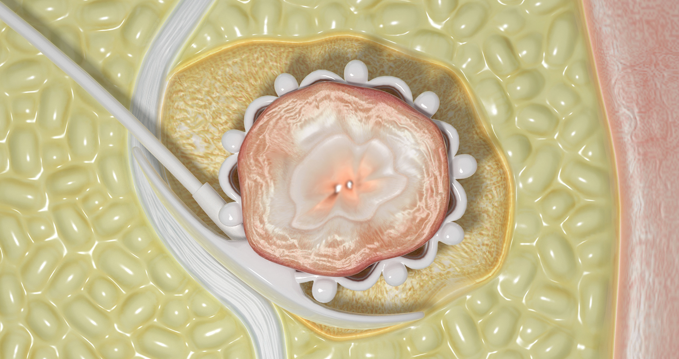 jean-pascal-donnot-illustration-rough-story-board-animation-medical-myopowers-lun-et-lautre
